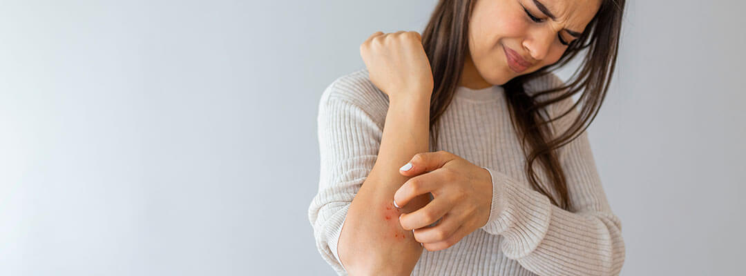 Freeing yourself of eczema starts with a healthy gut.